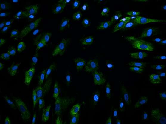 El análisis de una sola célula de la enfermedad de Crohn revela una imagen detallada de la inflamación en el intestino