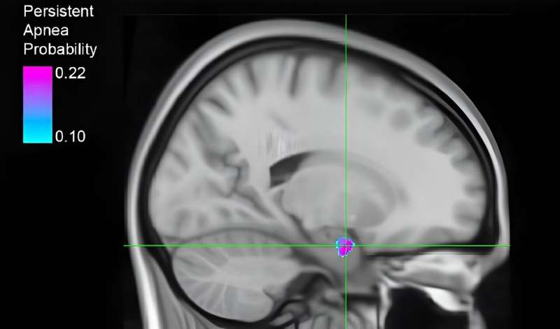 Small study identifies brain region associated with breathing failure following seizures