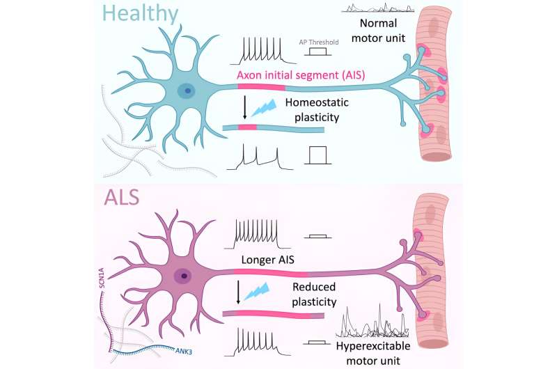 Specialised motor neuron region affected in amyotrophic lateral sclerosis