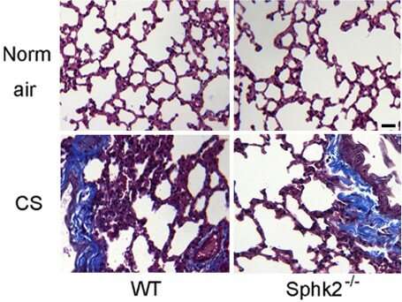 SphK2 tem um papel crucial na patogênese da DPOC