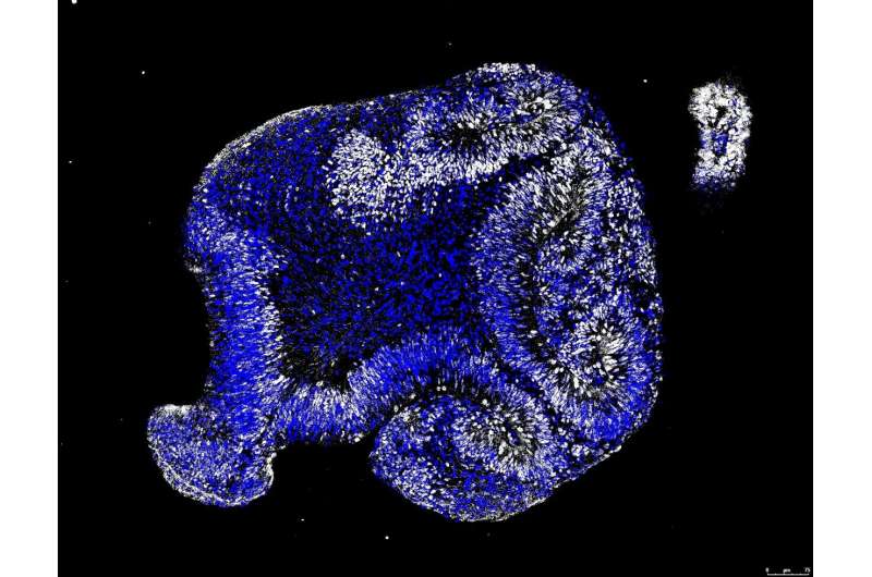 Stem cell model of human brain development suggests embryonic origins of Alzheimer's disease