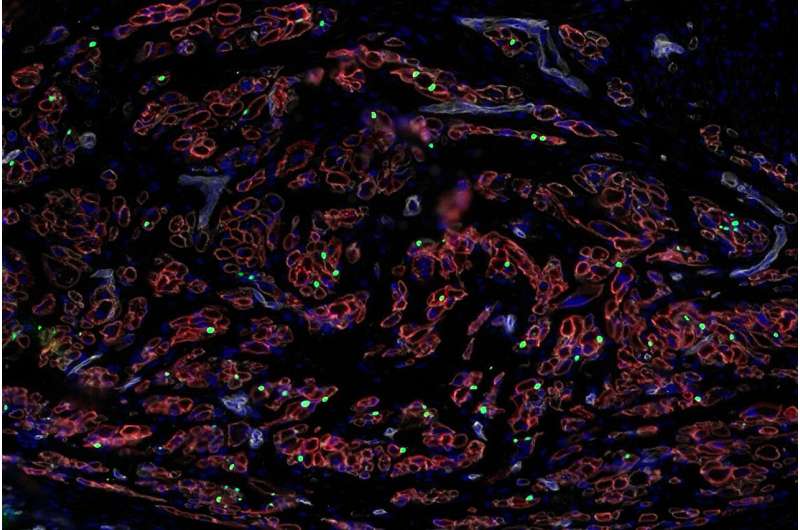 Stem cell research paves way toward regenerating skeletal muscle