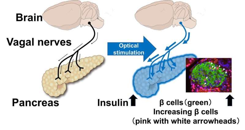Stimulating nerves connected to the pancreas regenerates insulin-producing cells