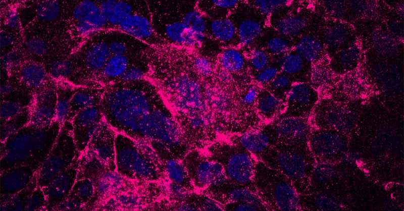 Stress-tolerant cells drive tumor initiation in pancreatic cancer