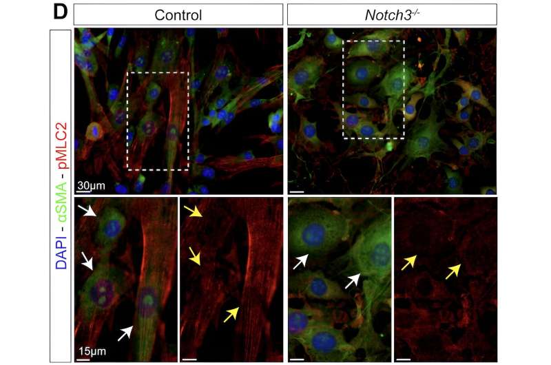 Study discovers novel biomarker for vascular aging and neurodegeneration
