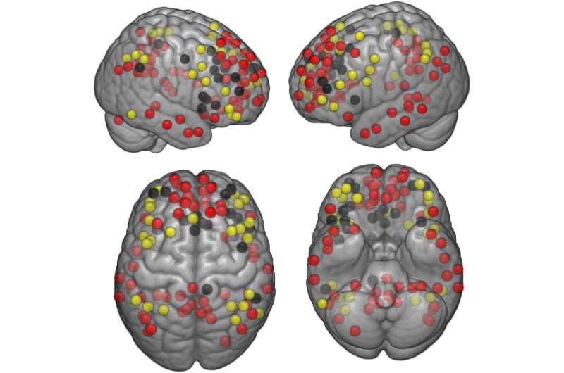 Study finds brain connectivity, memory improves in older adults after walking