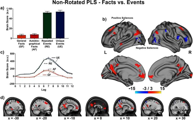 Study identifies how the brain handles different types of memory retrieval