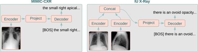Study identifies method for improving AI diagnoses of chest X-rays