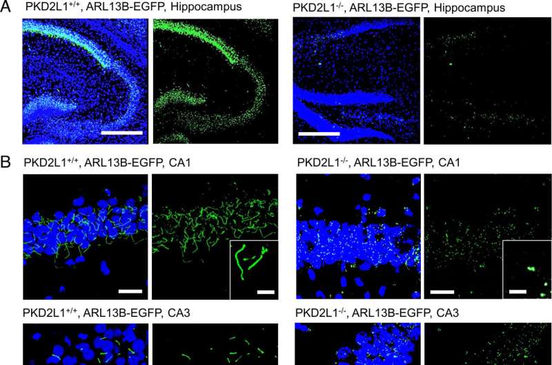 Study identifies novel regulators of hippocampal overactivity