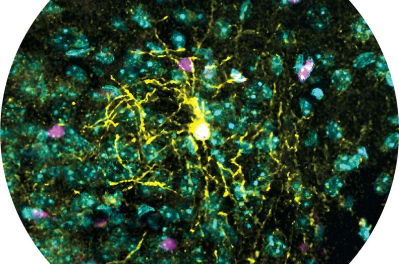 Study identifies sex differences in the brain cell types responding to stress