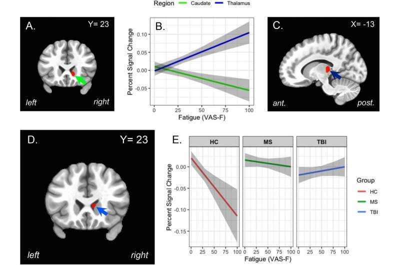 Study of cognitive fatigue across different tasks and populations provides new insights