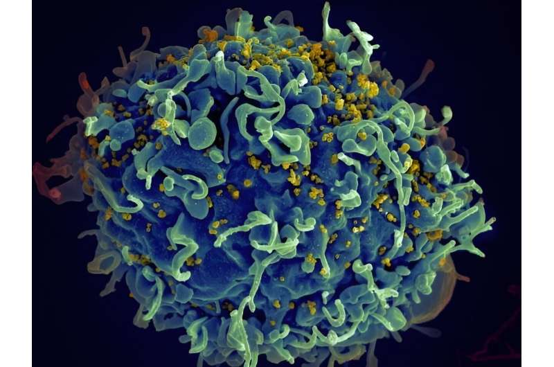 Study provides important insights for HIV treatment