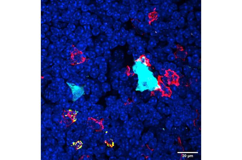Study reports discovery of new cell type in thymus