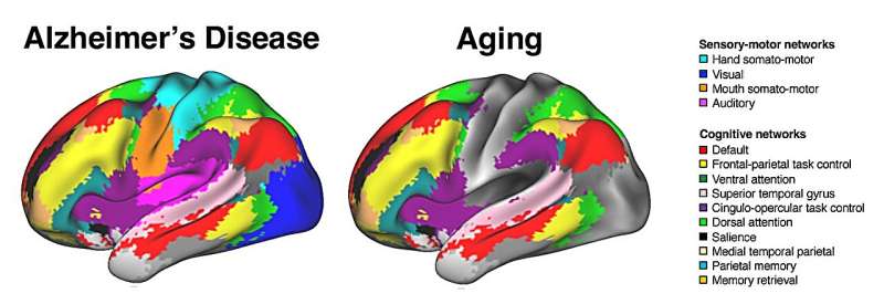 Study reveals broader impact of Alzheimer's on brain function