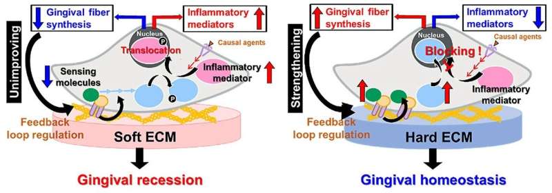 Study reveals that soft gums are more prone to inflammation