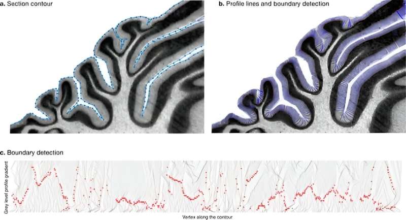 Study sheds light on evolution of brain folding in cerebellum of mammals
