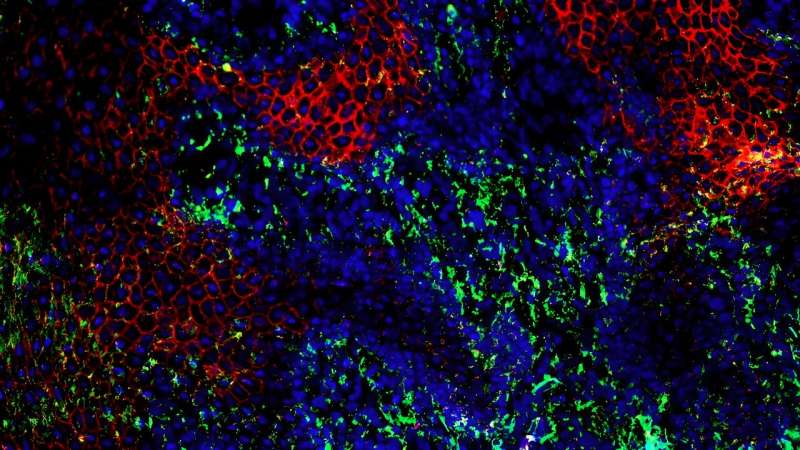 Study sheds light on why wounds often heal poorly in diabetics