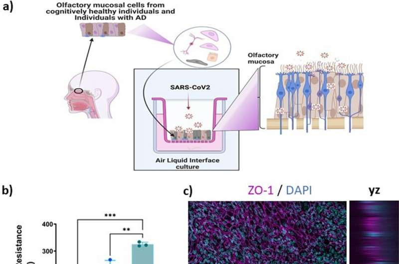 Study shows COVID-19 infection alters gene transcription of olfactory mucosal cells in Alzheimer's disease