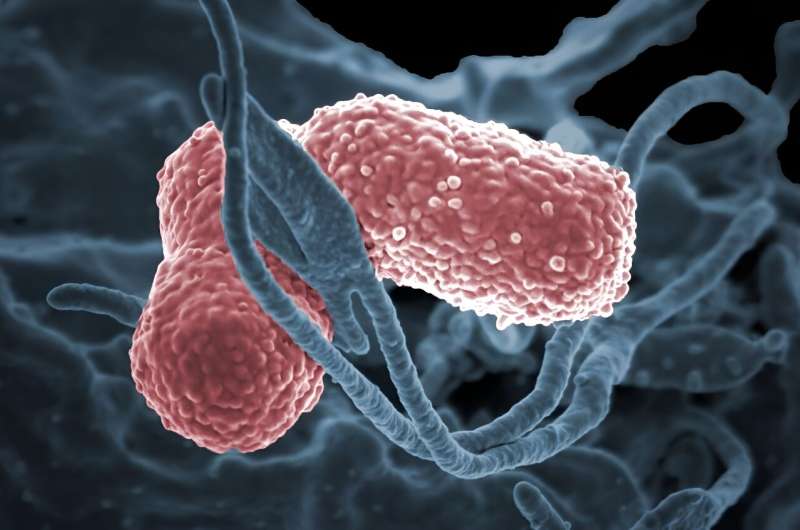 Study shows how 'superbacteria' were prevented from spreading in a large tertiary hospital