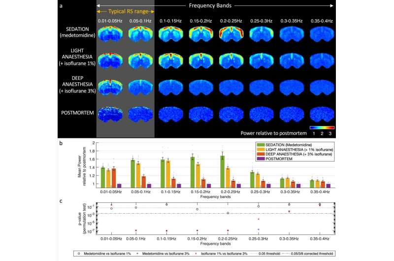 Study suggests the brain works like a resonance chamber