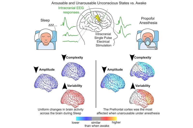 Study unveils the engagement of different cortical networks while humans are unconscious