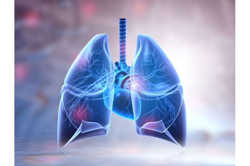 Suspected bronchiectasis linked to mortality with normal spirometry