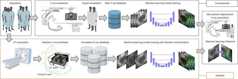 Synthetic data for AI outperform real data in robot-assisted surgery