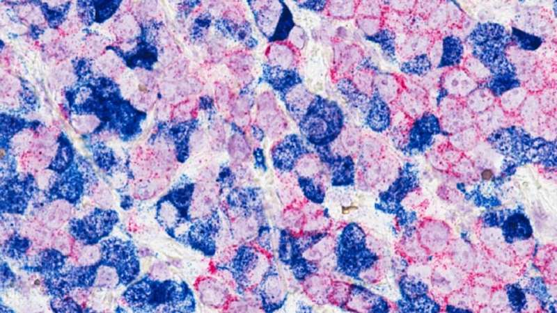 Targeting cancer-supporting cells boosts immunotherapy in previously insensitive tumours