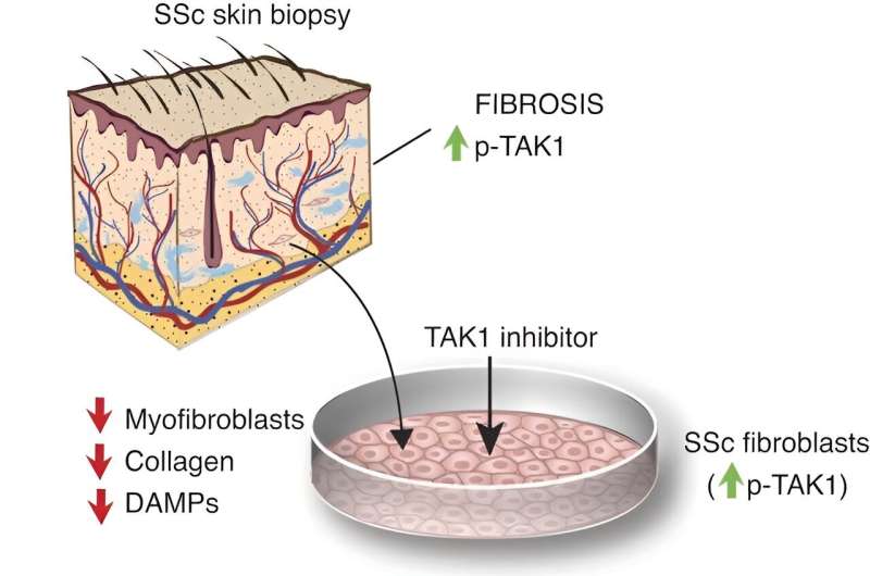 Targeting TAK1 protein to treat systemic sclerosis