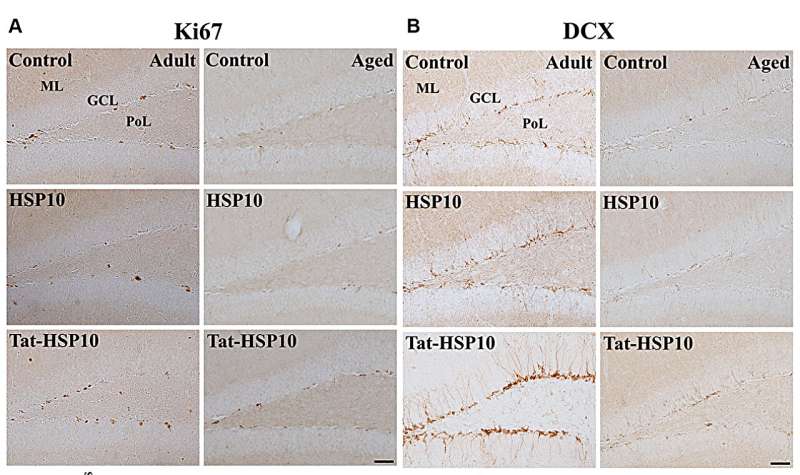 Tat-heat shock protein 10 ameliorates age-related phenotypes in the hippocampus