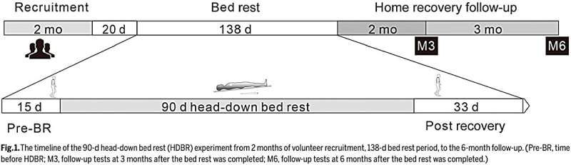 The Astronaut Center of China 90-d head-down bed rest: overview, countermeasures, and effects