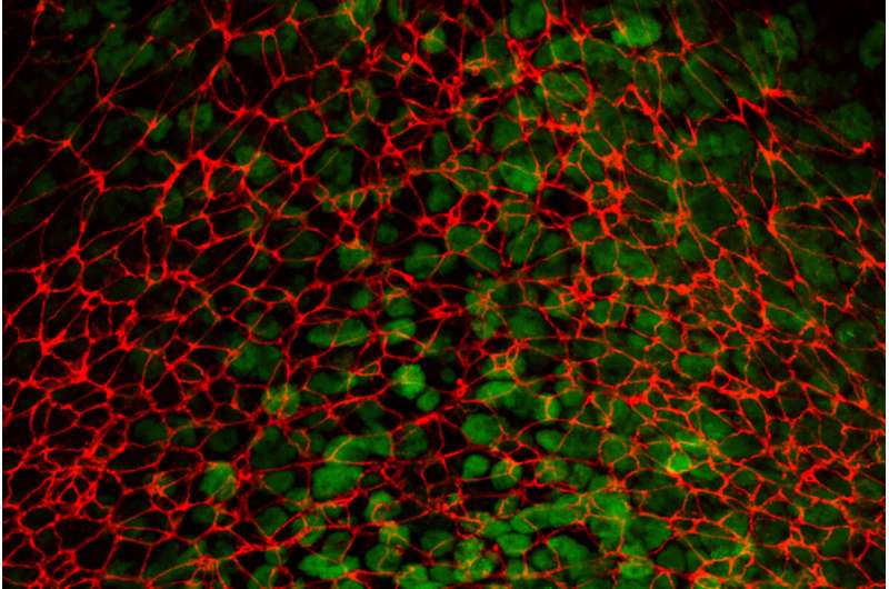 Os movimentos certos: como estudar o movimento celular durante o desenvolvimento embrionário pode oferecer novos insights sobre a metástase do câncer