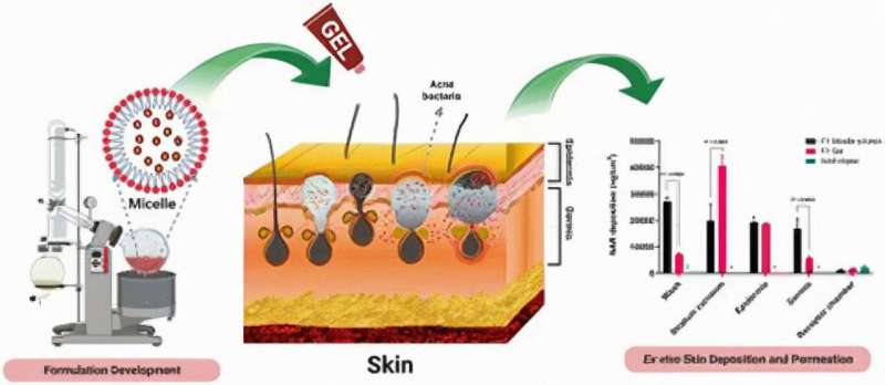 Tiny nanocarriers could prove to be the magic bullet for acne sufferers