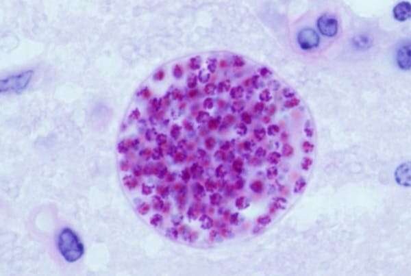 Toxoplasma: the parasite that takes over our brains