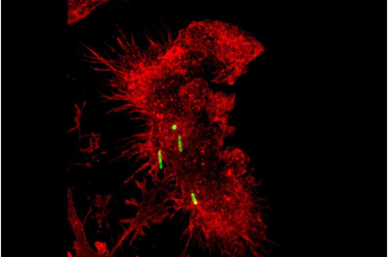 Training immune cells to remove 'trash' helps resolve lung inflammation