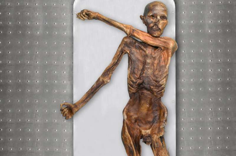 Ötzi: dark skin, bald head, Anatolian ancestry