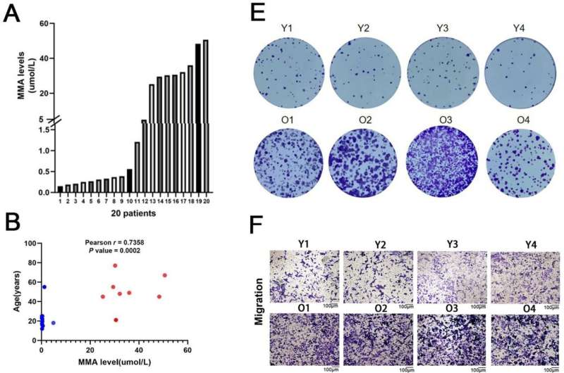 Unraveling the age-related cellular changes in osteosarcoma progression