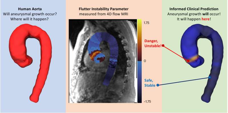 Unstable 'fluttering' predicts aortic aneurysm