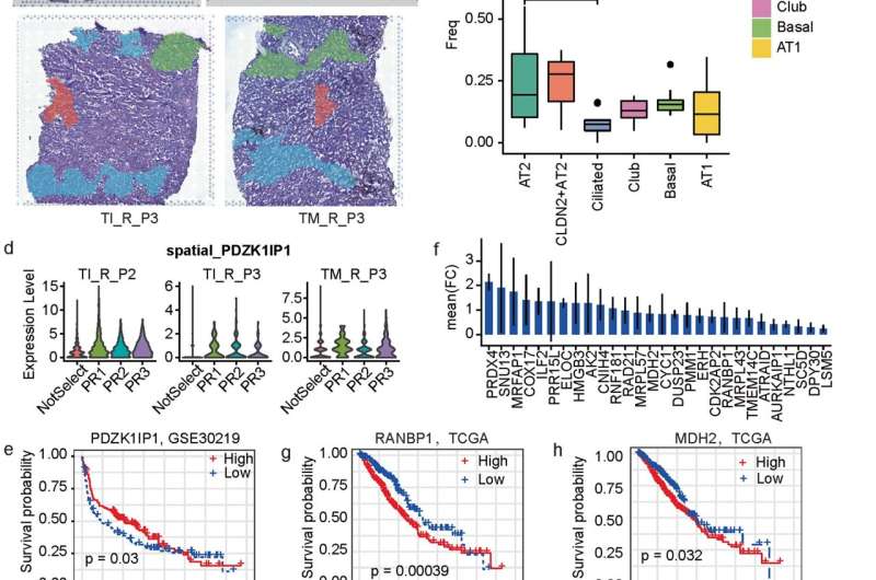 Unveiling cellular composition and spatial architecture of tumor microenvironment in multiple primary lung cancers