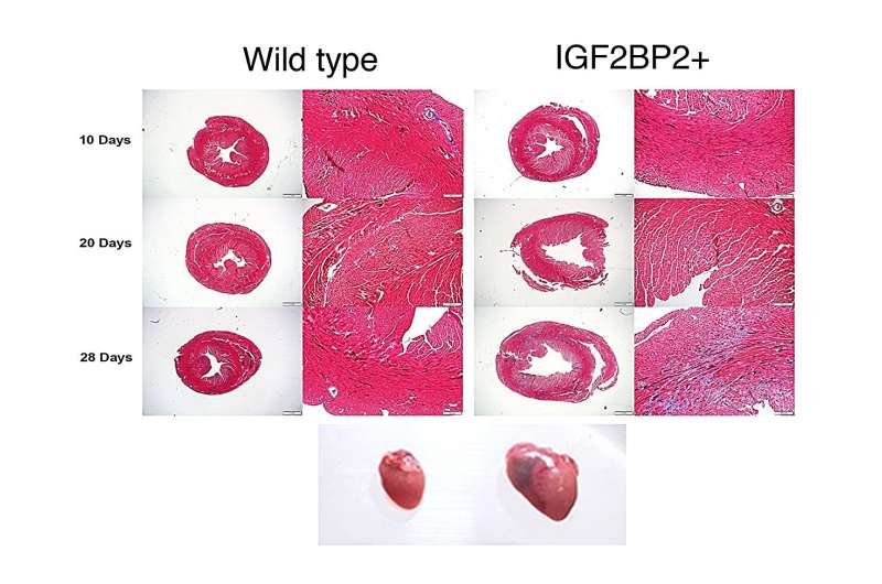 Unveiling heart's hidden hero: RNA binding protein IGF2BP2 identified as key player in stress-induced dilated cardiomyopathy