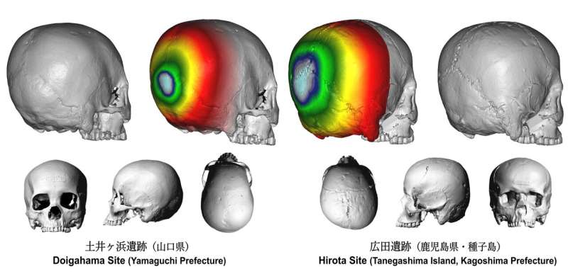 Unveiling Japan's ancient practice of cranial modification: The case of the Hirota people in Tanegashima
