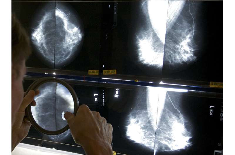 Os EUA exigem novas informações sobre a densidade da mama em todas as mamografias