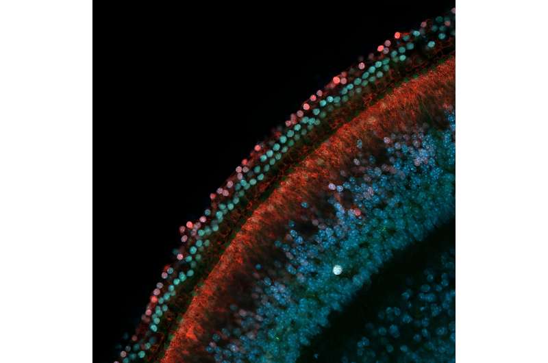 USC Stem Cell studies tune into hearing regeneration