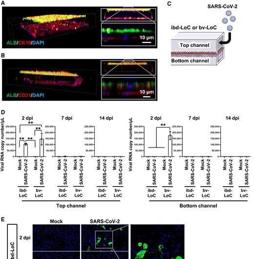 Using organ-on-a-chip technology to elucidate the liver pathophysiology of COVID-19 patients