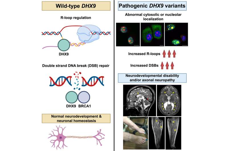 Variations in gene DHX9 underlie wide spectrum of human neurodevelopmental disorders and neuropathy