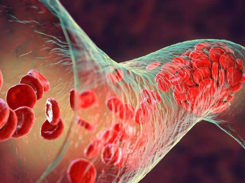 Venous thromboembolism risk low in COVID-19 outpatients