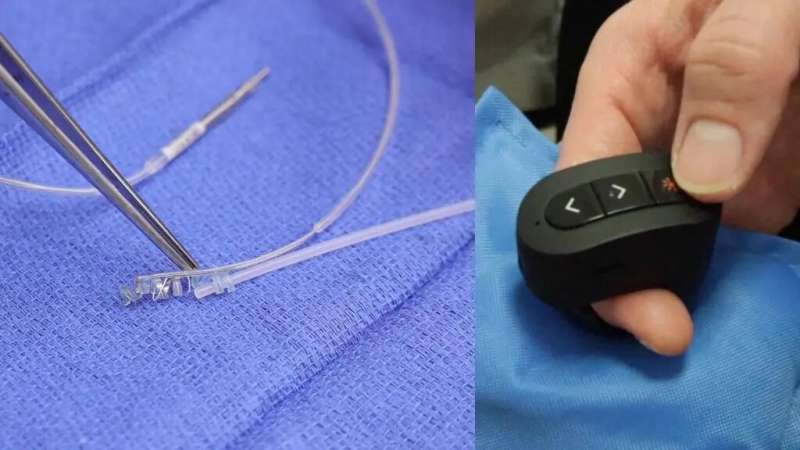 Video: How vagus nerve stimulation can help some patients improve their recovery after stroke
