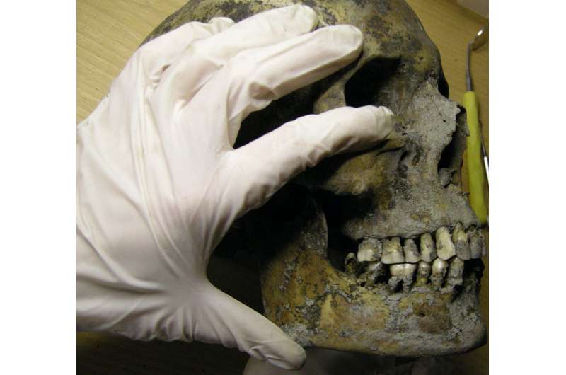 Vikings in Sweden suffered from tooth decay