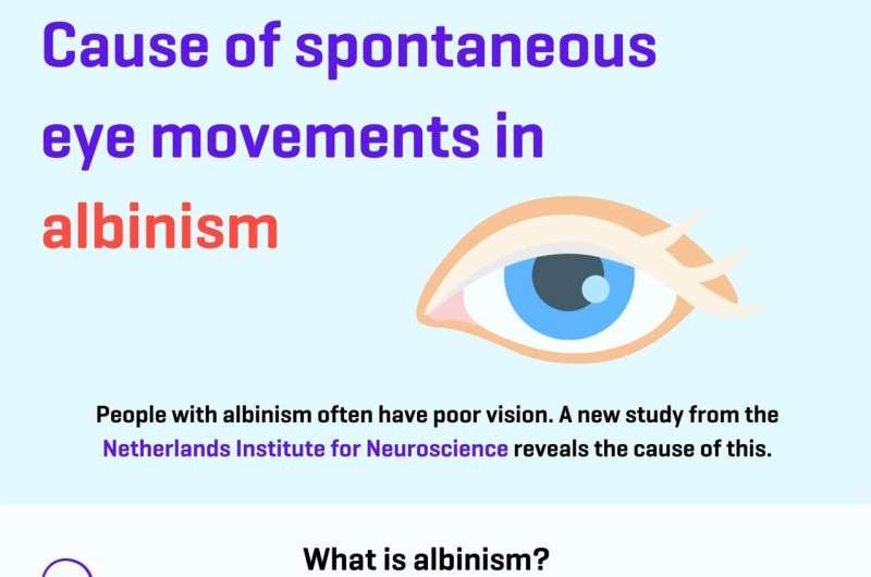 What causes spontaneous eye movements in albinism?