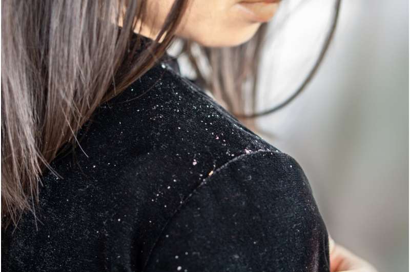 What is dandruff &amp;amp; how is it treated?